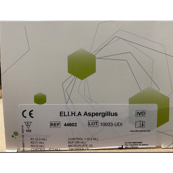 ASPERGILLOSIS FUMOUZE