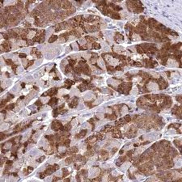 RABBIT GASTRIC LIPASE 100 MG